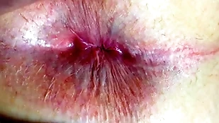 Ass together with anus closeup