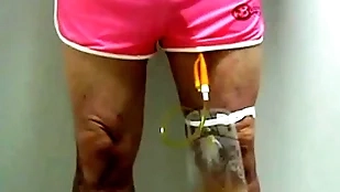 Catheter down collecting sac off out of one's mind pinky 396